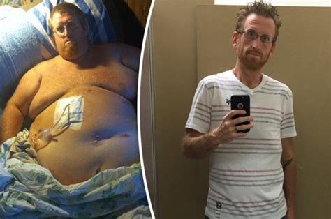 Man Makes Miraculous Weight Loss Transformation After 33st Figure Killed Sex Drive Daily Star