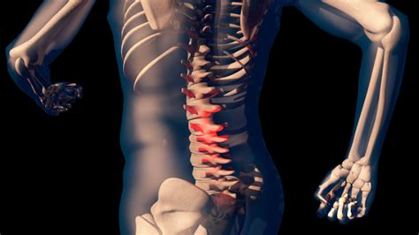 Adjustment Vs Decompression Fitness Chiropractic And Massage Therapy®