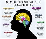 Pictures of Cannabinoid Treatment Multiple Sclerosis