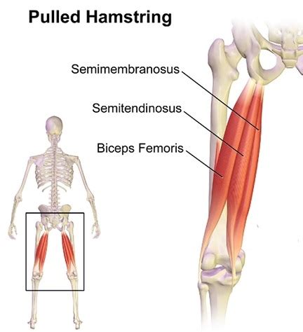 Besides arm anatomy, we'll also teach you about some common conditions that can affect the arm the arms are the upper limbs of the body. Muscles Of Posterior Fascial Compartment Of The Thigh ...