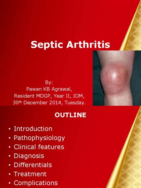 Septic Arthritis By Pawan Kb Agrawal Resident Mdgp Year Ii Iom 30