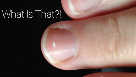 Why We Get White Spots Under Our Nails Alltop Viral