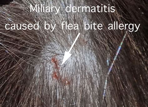 Flea Bite Allergy Pictures Photos