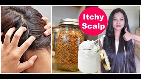 35 Get Rid Of The Itching Whos Needs To