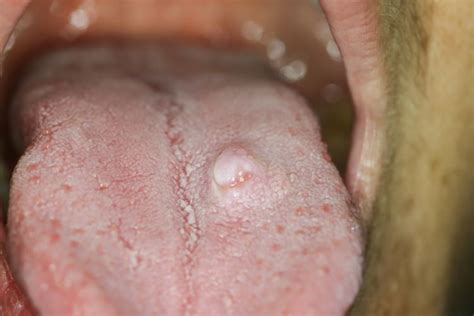 What The Tongue Says About Health 7 Pictures