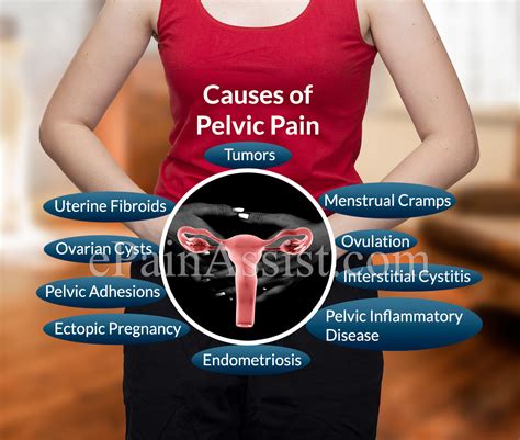10 Causes Of Pelvic Pain In Females
