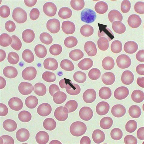 Platelets Under Microscope