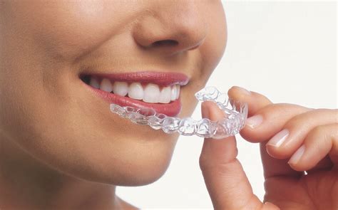 What Is Invisalign And How Does It Move Teeth Part 1 Jorgensen
