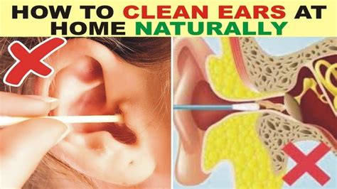 How To Clean Ears At Home Naturally Ear Cleaning Cleaning Ear