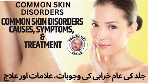 Common Skin Disorders Causes Symptoms And Treatment Youtube
