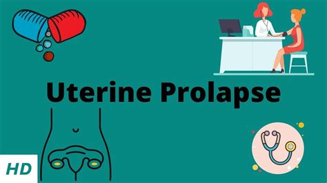 Uterine Prolapse Causes Signs And Symptoms Diagnosis And Treatment Youtube