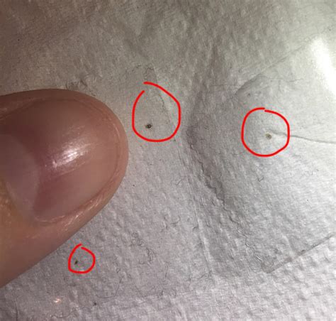 Are These Bed Bugs Rbedbugs