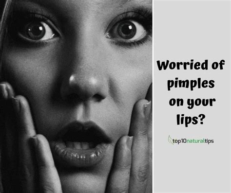 How To Get Rid Of Pimples On Lip Line Areas Top10 Natural Tips