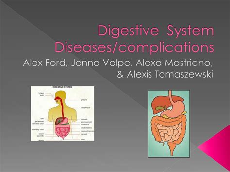 Ppt Digestive System Diseasescomplications Powerpoint Presentation