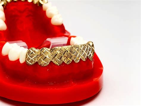 10k Solid Yellow White Rose Gold Custom Fit Diamond Cut Dust Grill Gold