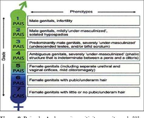 Figure 1 From Partial Androgen Insensitivity Syndrome Multidisciplinary Approach Genetic
