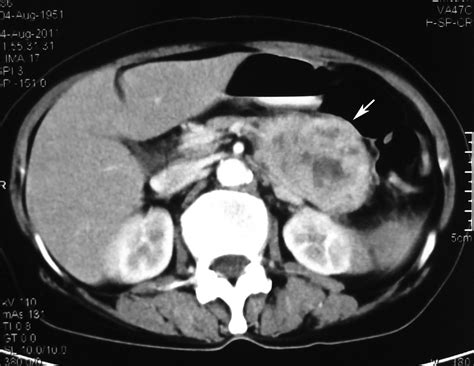 Radiodiagnosis Imaging Is Amazing Interesting Cases