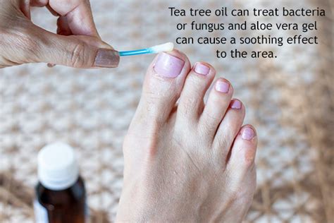 Foot Rashes Causes Treatment And Home Remedies
