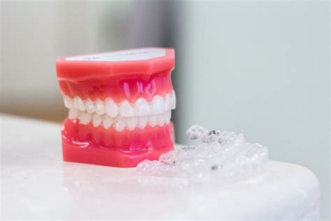 The Top Myths About Braces Glass Orthodontics