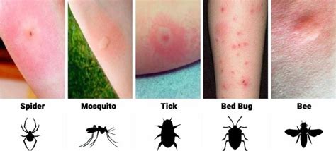 Pin By Michelle Glenda On Bugsinsectspests “homemade Repellents” In