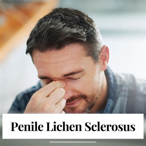 Penile Lichen Sclerosus Treatment In London And Kent Elite Aesthetics