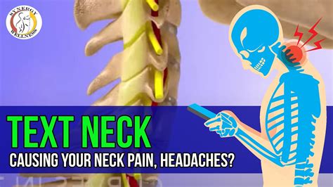 Text Neck Causing Your Neck Pain Headaches And Neck Stiffness Youtube