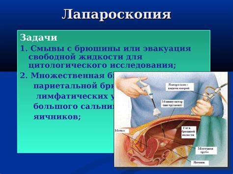 Рак яичников диета Рак яичников - презентация онлайн Рак яичников - презентация онлайн Рак яичников диета