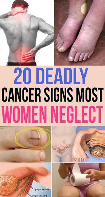 20 Deadly Cancer Signs Most Women Neglect Wellness Days