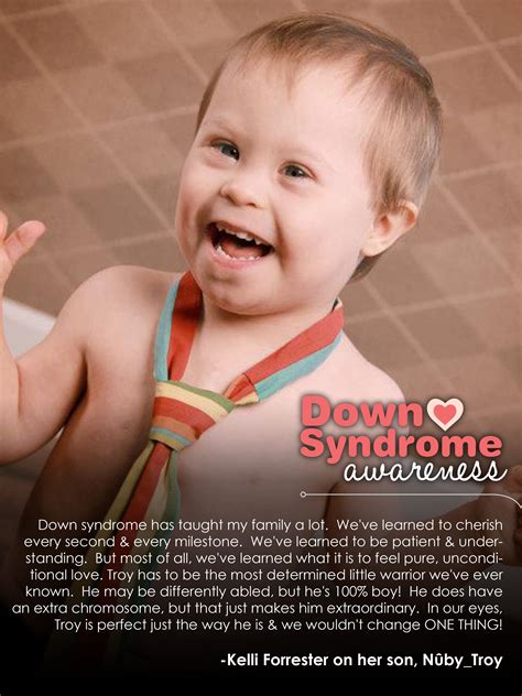 Pin by Nûby USA on Peace, Love & Down Syndrome | Down syndrome, Down syndrome kids, Down 