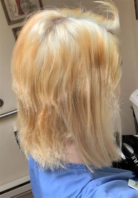 There are natural dye options to also consider. Teen's hair MELTS and falls out after home bleaching goes ...