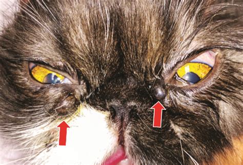 Treatment Of Eyelid Tumors With A Co2 Laser