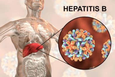 Diagnostic testing in hepatitis c virus infection. Hepatitis B: Ansteckung, Symptome, Behandlung, Schutz ...