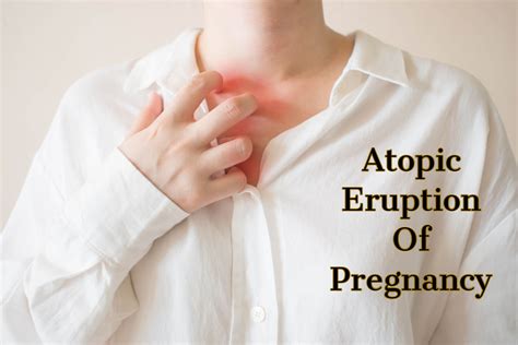 Atopic Eruption Of Pregnancy Causes Symptoms And Treatment Being