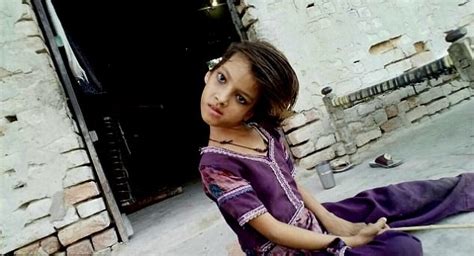 nine year old pakistani girl whose head hangs at 180 degree angle is forced to live as an