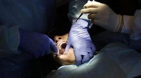 England Woman Chokes After Dentist Drops Pin Inside Her Mouth World