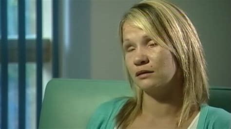 Woman S Eyes Gouged Out By Lover Video Abc News