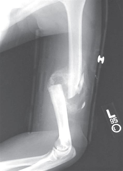 Bone Openstax Biology 2e