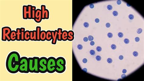 High Reticulocyte Count Reticulocytosis Causes Youtube