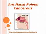 Images of Cancerous Polyps In Colon Treatment