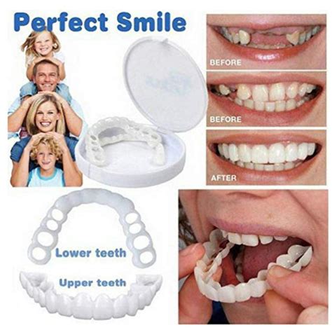 Buy Llld Safe Silicone Imitation Braces Teeth Decoration Kits