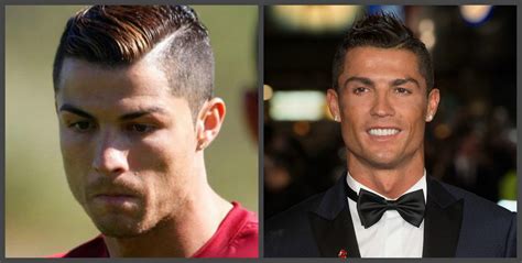 Cristiano Ronaldo Dentes Antes E Depois Uma Seleção De Fotos