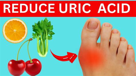 Top 9 Foods To Naturally Lower Uric Acid Levels Youtube