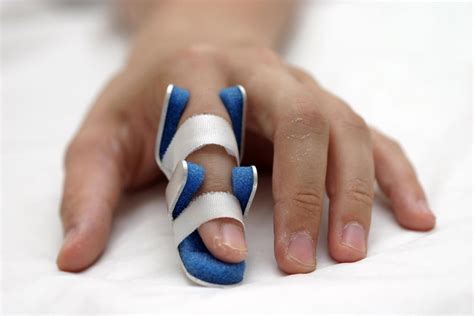 Sprained Finger Symptoms Treatment And Recovery