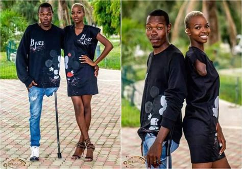 Love Is Blind Amputee Couple Shares Cute Photos