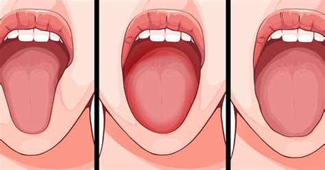 What The Shape And Appearance Of The Tongue Signifies For Health