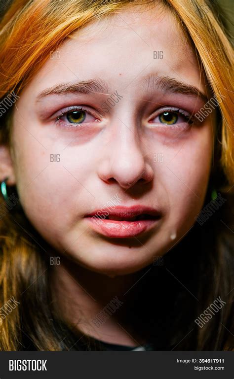 Little Sad Girl After Image And Photo Free Trial Bigstock