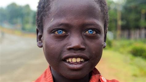 Dark Skinned Africans With Extraordinary Blue Eyes