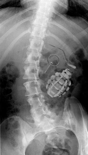 44 Best Images About Radiology And X Ray Humor On Pinterest