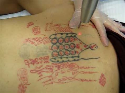 Tattoo costs can range from thirty dollars to thousands of dollars. The Tattoo World : Laser Tattoo Removal Cost