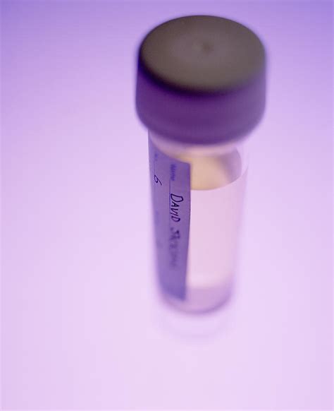 Urine Sample Photograph By Lawrence Lawry Fine Art America